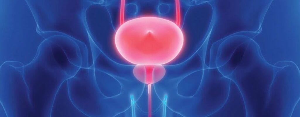 Cancer de prostata