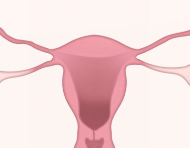 Quimioterapia