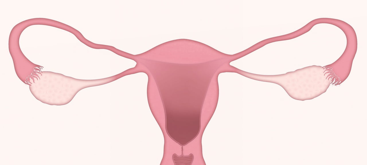 Quimioterapia