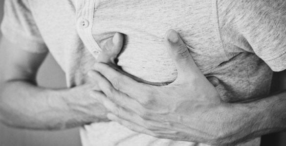 Homocisteína elevada 23 infarto de miocardio