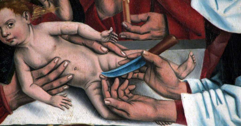 Circuncisión de Jesús, Friedrich Herlin, 1466.