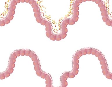 Microbiota
