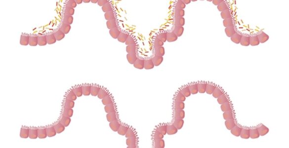 La microbiota. Su importancia en la salud 22 Microbiota