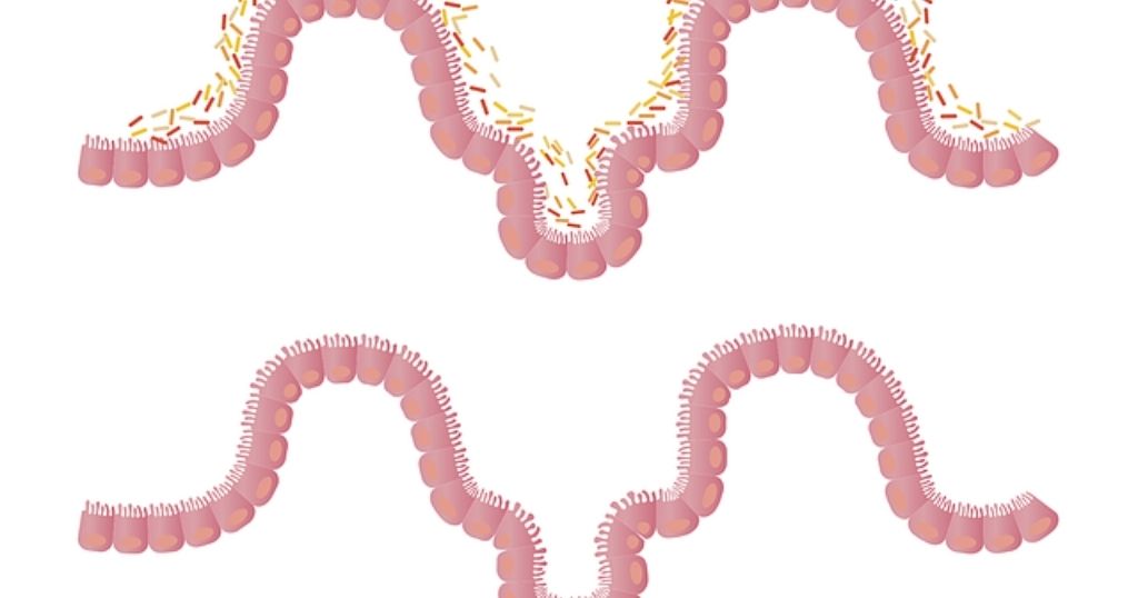 Microbiota
