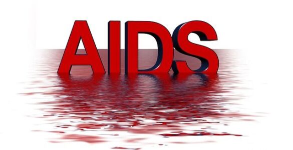 Efecto de la hipnosis relajante en pacientes infectados con HIV 13 Sida